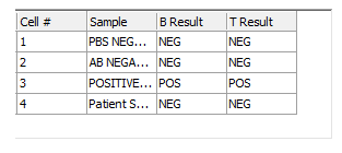 Figure T15.42 Completed 'HLA Results' Data Grid Figure T15.42 Completed 'HLA Results' Data Grid