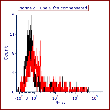 Figure T11.32  Histogram with Overlay